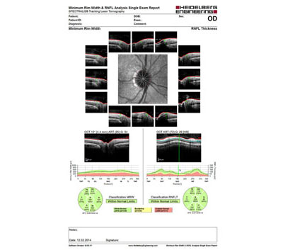 spectralis mrw rnfl od